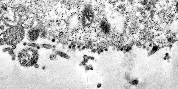 Incidência de SRAG parou de cair e pode voltar a crescer, diz Fiocruz