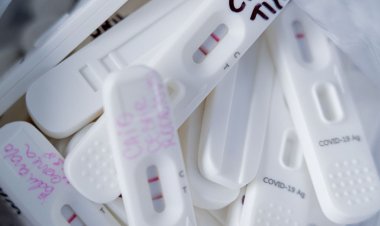 Procon-SP fiscaliza preços abusivos de testes de covid-19