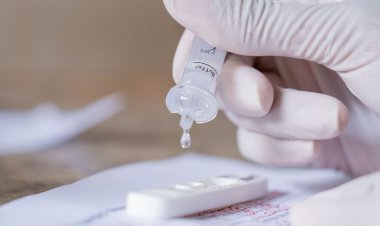 Procura por testagem para covid-19 diminui no Rio de Janeiro