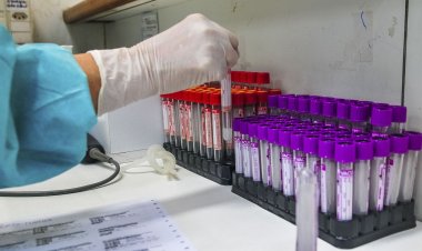 Covid-19: Câmara aprova projeto que incentiva doações para pesquisas