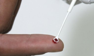 Pesquisadores da Fiocruz analisam coinfecção por HIV e HTLV na Bahia