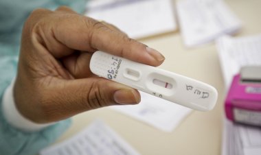 Casos de covid-19 chegam a 27,4 milhões no Brasil