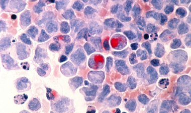 Anvisa aprova primeira terapia gênica contra câncer no Brasil