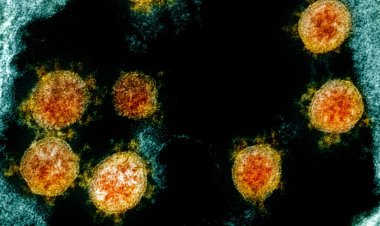 Fiocruz e Harvard explicam em estudo inflamação excessiva da covid-19