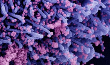 Mais de 98% dos paulistanos adultos têm anticorpos contra covid-19