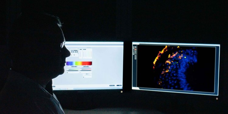 Estudo busca identificar tratamento gênico para Síndrome de Pitt-Hopki