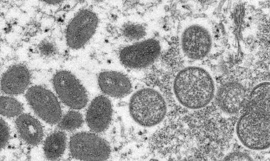 Saúde monitora sete casos suspeitos de varíola dos macacos