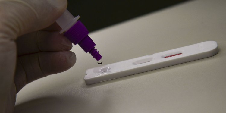 Fiocruz: casos de síndrome respiratória grave atingem patamar estável