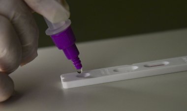 Covid-19: Brasil registra 266 óbitos e 77,1 mil casos em 24 horas