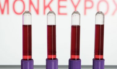 Primeiras vacinas contra varíola dos macacos devem chegar em setembro