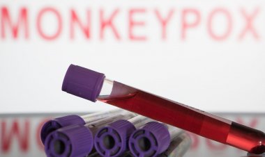 Brasil faz 8.850 testes de varíola dos macacos