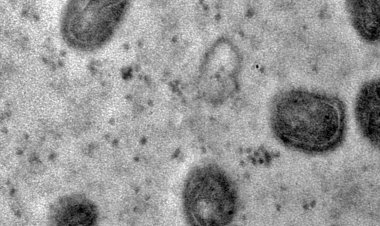 Fiocruz registra imagens de replicação do vírus monkeypox em célula