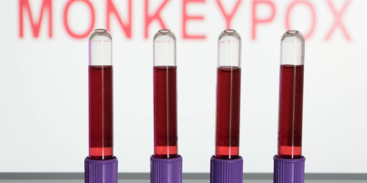 Anvisa autoriza uso emergencial de kits para varíola dos macacos