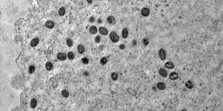 Rio de Janeiro registra segunda morte por varíola dos macacos no país