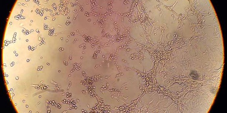 SP: Praia Grande confirma morte de homem por varíola dos macacos