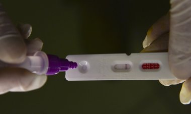 Hospitalizações por covid-19 mantêm tendência de alta nos estados