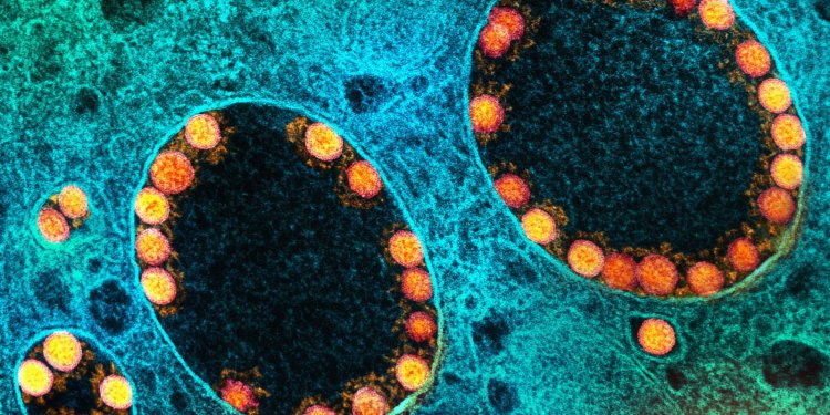 Covid-19 aumenta em 12 estados, diz Fiocruz