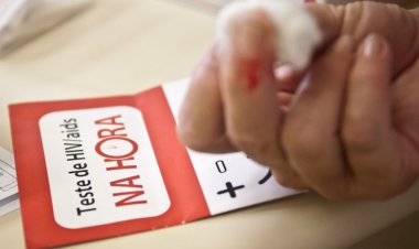 Mortalidade por Aids cai 78% desde 1995 em São Paulo