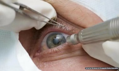 Médicos alertam para riscos de cirurgia de mudança da cor dos olhos