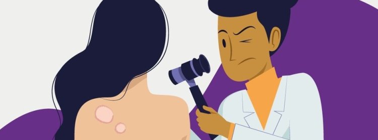 Governo de Minas reforça o alerta e a conscientização da sociedade no combate à hanseníase