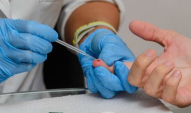 Secretaria de Saúde de Minas reforça importância da prevenção, testagem e tratamento precoce da sífilis